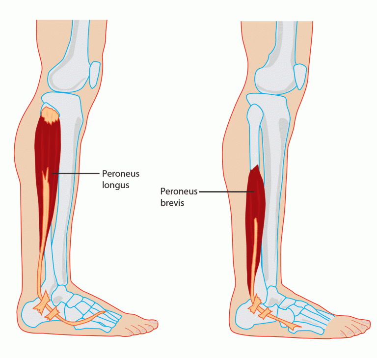 peroneus-tendinopathie-wat-is-het-precies-shockwave-nl